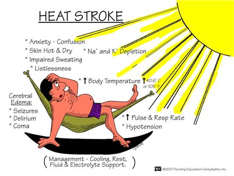 Hot Stroke Brabet